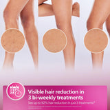 جهاز إزالة الشعر فيليبس سلسلة 9000 - JawdaTop