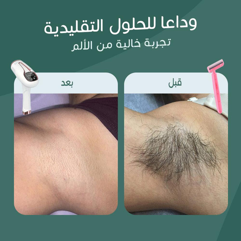 جهاز ليزر منزلي مع خاصية التبريد - JawdaTop